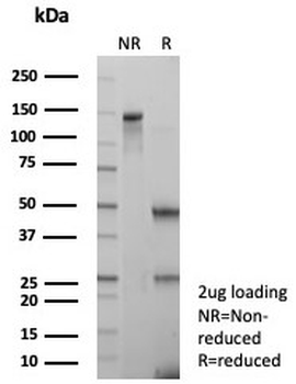 Ki-67 Antibody