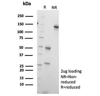 VMAT2 Antibody / SLC18A2