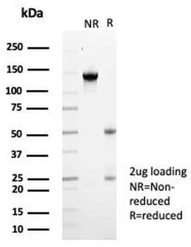 KChIP2 Antibody / KCNIP2