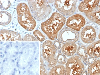 KCNIP2 Antibody / KChIP2