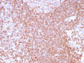 CD39 Antibody