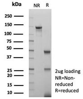 Ki-67 Antibody