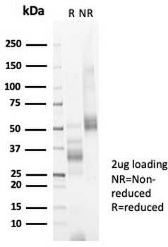 Ki-67 Antibody