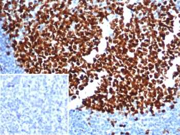 Ki-67 Antibody