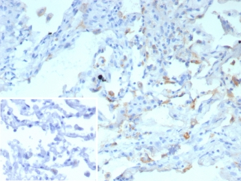 SFTPD Antibody / Surfactant protein D