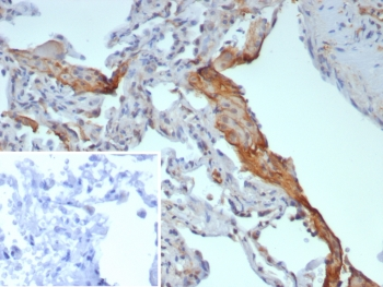 Surfactant protein D Antibody