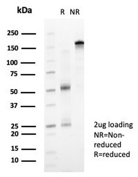 ZNF239 Antibody