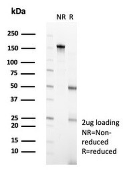 POGZ Antibody / Pogo transposable element with ZNF domain