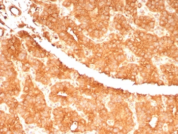 c-RET Antibody