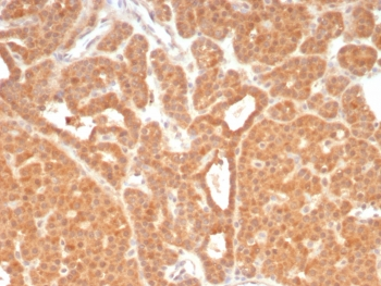 c-RET Antibody