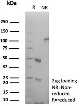 Integrin beta 1 Antibody / ITGB1 / CD29