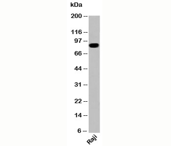 IKKb Antibody