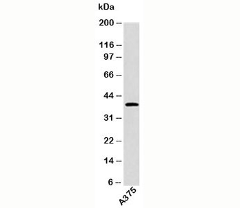 EDG1 Antibody