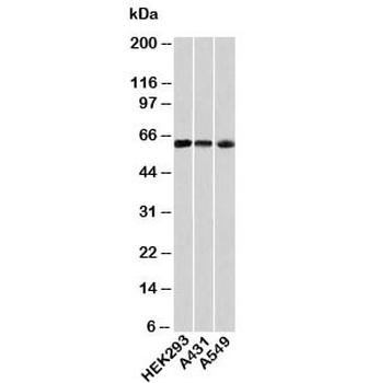 HSP60 Antibody / HSPD1