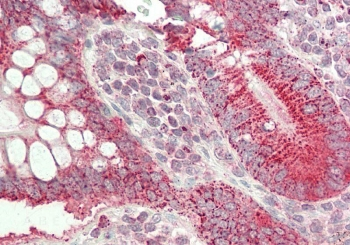 HSP60 Antibody / HSPD1