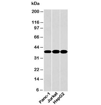 GAPDH Antibody Loading Control