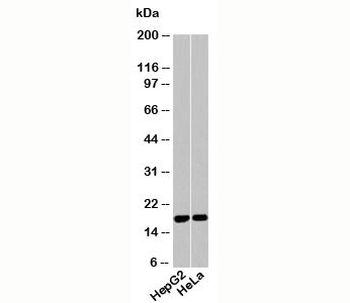 Acid Phosphatase Antibody (Isoform 2 specific)