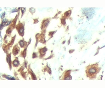 ATF6 Antibody