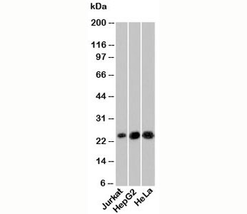 NKIRAS1 Antibody