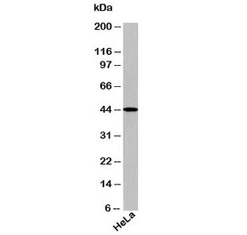 TARBP2 Antibody