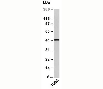 CRHR2 Antibody