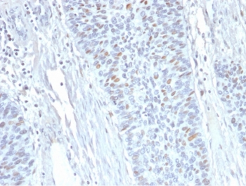 Cyclin A2 Antibody / CCNA2
