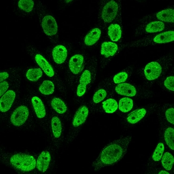 Cyclin B1 Antibody