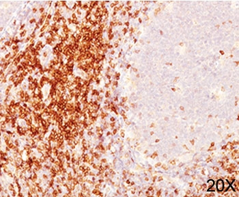CD6 Antibody Cocktail
