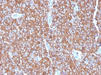 Chromogranin A Antibody Cocktail