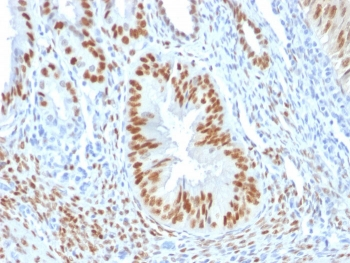 ER Antibody / Estrogen Receptor alpha