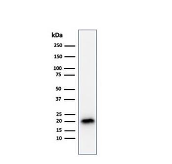 MART-1 / Melan-A Antibody