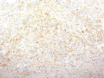 Fibronectin Antibody