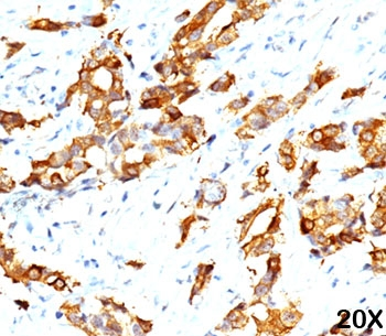 HSP27 Antibody / HSPB1