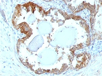 HSP27 Antibody / HSPB1