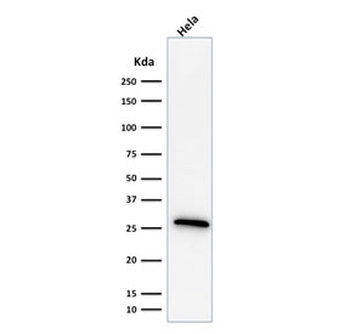 HSP27 Antibody / HSPB1