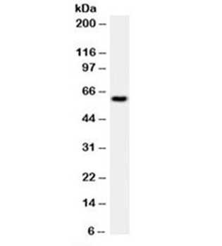 HSP60 Antibody