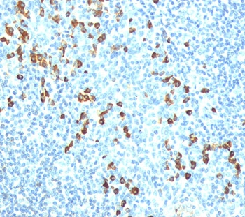 IgM Heavy Chain Antibody