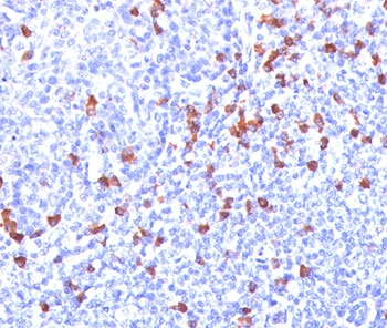 Kappa Light Chain Antibody