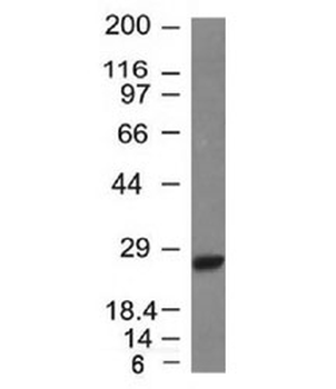 Kappa Light Chain Antibody