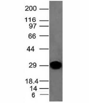 Kappa Light Chain Antibody