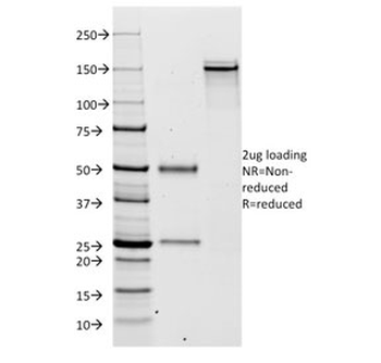 Kappa Light Chain Antibody