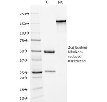 Kappa Light Chain Antibody
