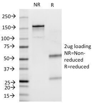 Insulin Antibody
