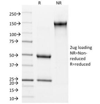 Involucrin Antibody