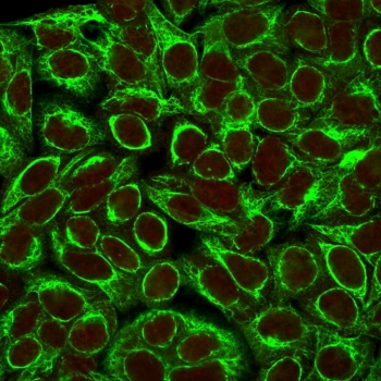 KRT8 Antibody / Cytokeratin 8