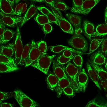 KRT8 Antibody Cocktail / Cytokeratin 8