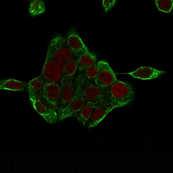 KRT8 Antibody Cocktail / Cytokeratin 8