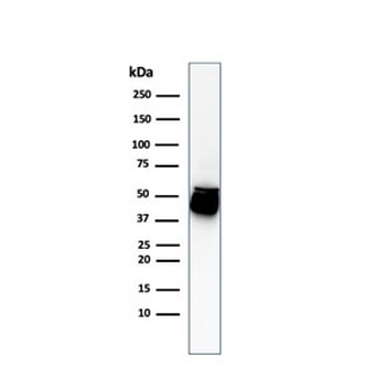 KRT8 Antibody Cocktail / Cytokeratin 8