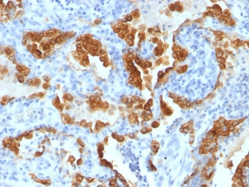 KRT8 Antibody Cocktail / Cytokeratin 8