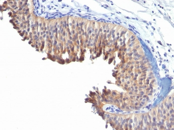 KRT10 Antibody / Cytokeratin 10